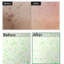 VT Cosmetics Reedle Shot 100 Essence 50ml (2)