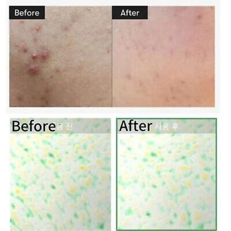 VT Cosmetics Reedle Shot 100 Essence 50ml (2)