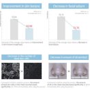 Round Lab 1025 Dokdo Lotion για Καταπράυνση και Λάμψη