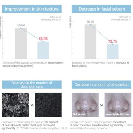 Round Lab 1025 Dokdo Lotion για Καταπράυνση και Λάμψη