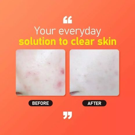 jumiso all day vitamin brightening balancing serum Jumiso All Day Vitamin Brightening & Balancing Serum Προϊόν Ορός προσώπου με Βιταμίνη C και Centella Asiatica για λάμψη