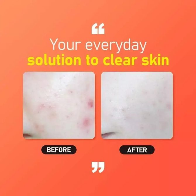 jumiso all day vitamin brightening balancing serum Jumiso All Day Vitamin Brightening & Balancing Serum Προϊόν Ορός προσώπου με Βιταμίνη C και Centella Asiatica για λάμψη