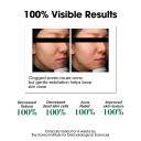 Some By Mi AHA BHA PHA 30 Days Miracle Toner λοσιόν απολέπισης για λιπαρό δέρμα 150ml