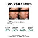 Some By Mi AHA BHA PHA 30 Days Miracle Toner λοσιόν απολέπισης για λιπαρό δέρμα 150ml