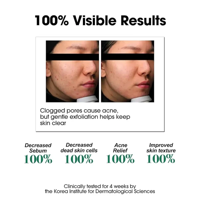 some-by-mi-aha-bha-pha-30-days-miracle-toner-150ml (5) Some By Mi AHA BHA PHA 30 Days Miracle Toner λοσιόν απολέπισης για λιπαρό δέρμα 150ml