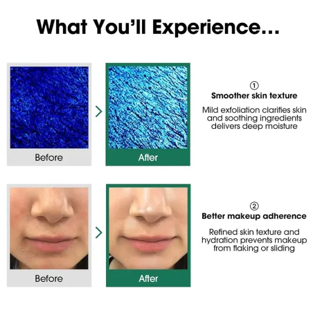 Some By Mi AHA BHA PHA 30 Days Miracle Toner λοσιόν απολέπισης για λιπαρό δέρμα 150ml