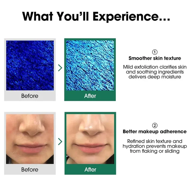 some-by-mi-aha-bha-pha-30-days-miracle-toner-150ml (8) Some By Mi AHA BHA PHA 30 Days Miracle Toner λοσιόν απολέπισης για λιπαρό δέρμα 150ml