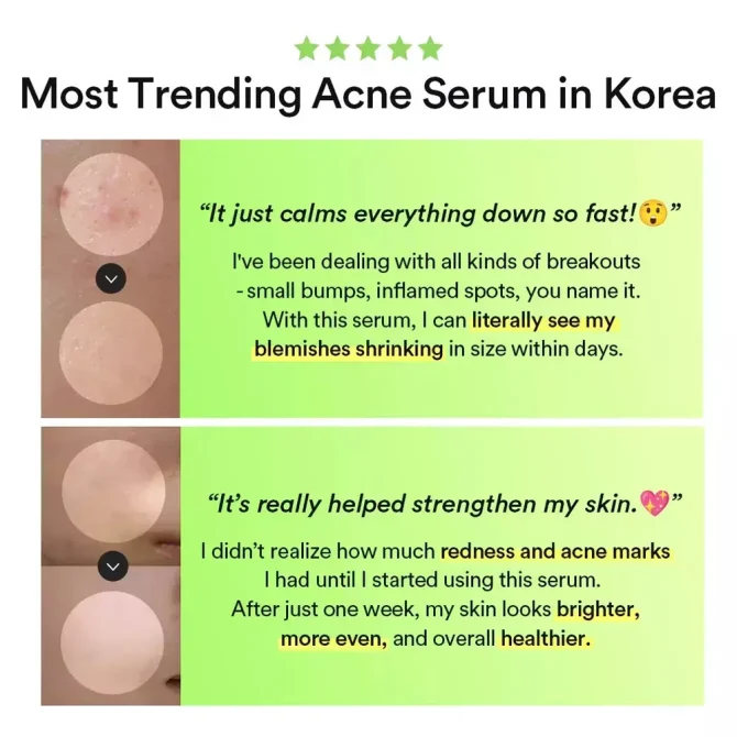 Abib Heartleaf Καταπραϋντικό Serum Προσώπου με Centella Asiatica 50ml