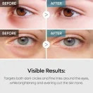 Dr. Melaxin TX Retinalsome Κρέμα Ματιών για Λάμψη 40gr - Ενυδατική & Αναζωογονητική