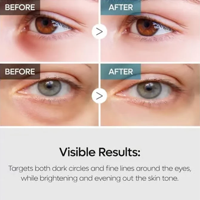 Dr. Melaxin TX Retinalsome Κρέμα Ματιών για Λάμψη 40gr - Ενυδατική & Αναζωογονητική