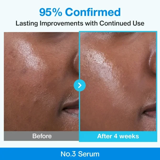 Numbuzin No.3 Blue Bio-Retinol Serum με Νιασιναμίδη για Σύσφιξη - 30ml