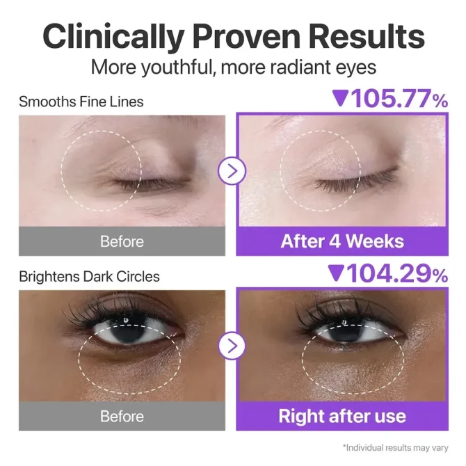 Numbuzin No.9 NAD Retinol Volumetox eye cream 10ml 4 Numbuzin No.9 NAD Retinol Volumetox Κρέμα Ματιών 10ml για Σύσφιξη & Αντιγήρανση