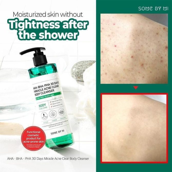 Some By Mi 30 DAYS MIRACLE Gel 2 Some By Mi 30 DAYS MIRACLE Gel 2