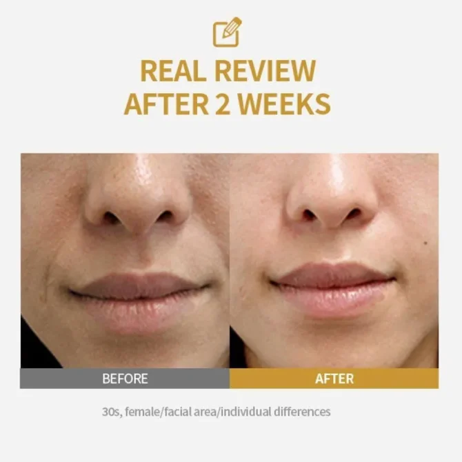 Sungboon Editor Silk Serum Προσώπου με Πεπτίδια για Φυσικό Lifting 35ml