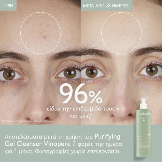 Caudalie Vinopure Gel 6